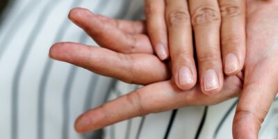 Nail Issues: Causes, Treatment, and Tips